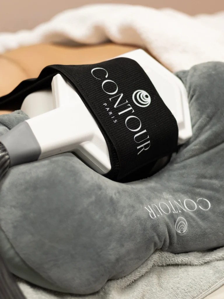 cryolipolise sur la cuisse